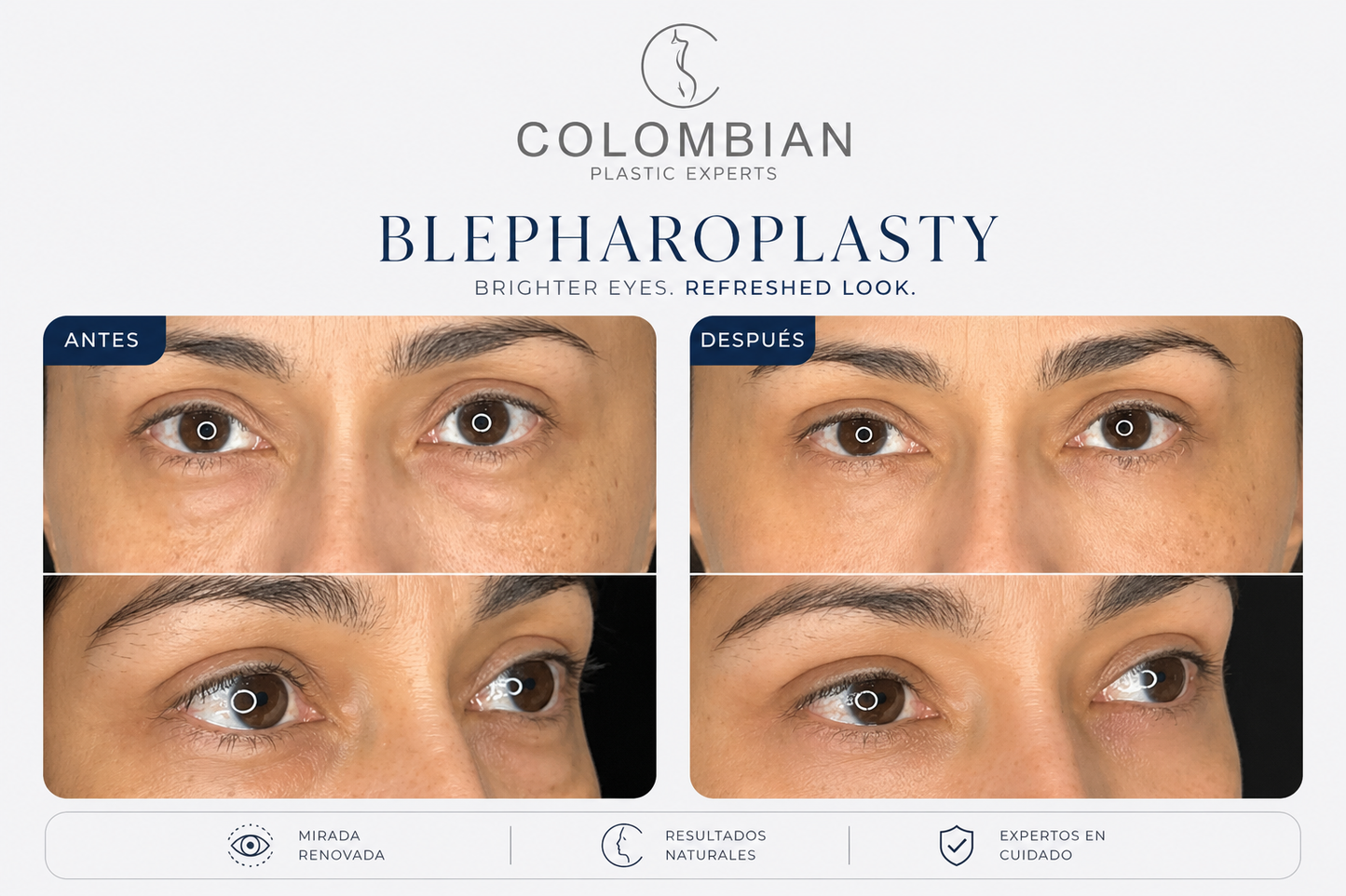 Miami Event Deposit | Dr. Neyfer Figueroa | 2 or more procedures