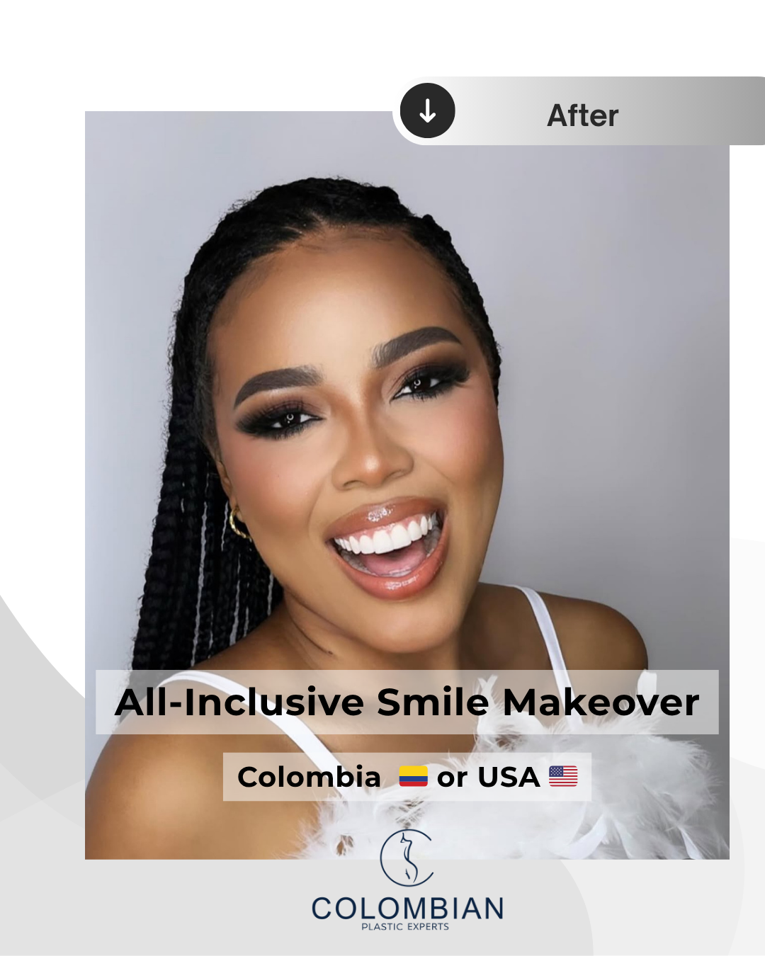 Full Payment – Smile Makeover Package (Cartagena, Colombia)