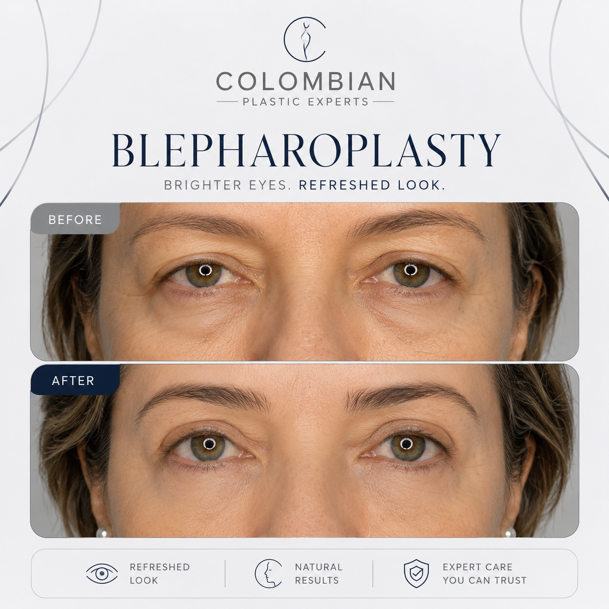 Miami Event Deposit | Dr. Neyfer Figueroa | 2 or more procedures