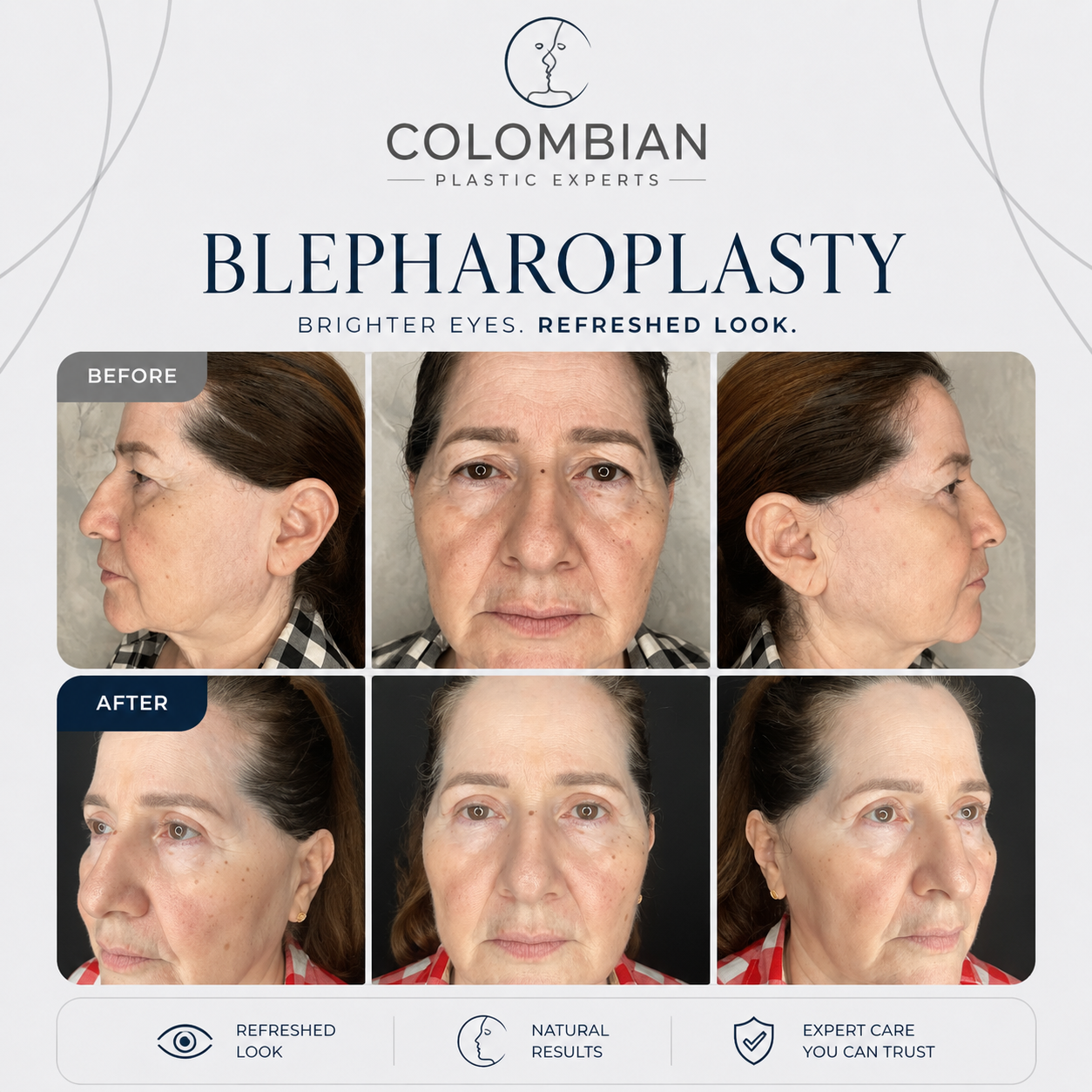 Miami Event Deposit | Dr. Neyfer Figueroa | 2 or more procedures