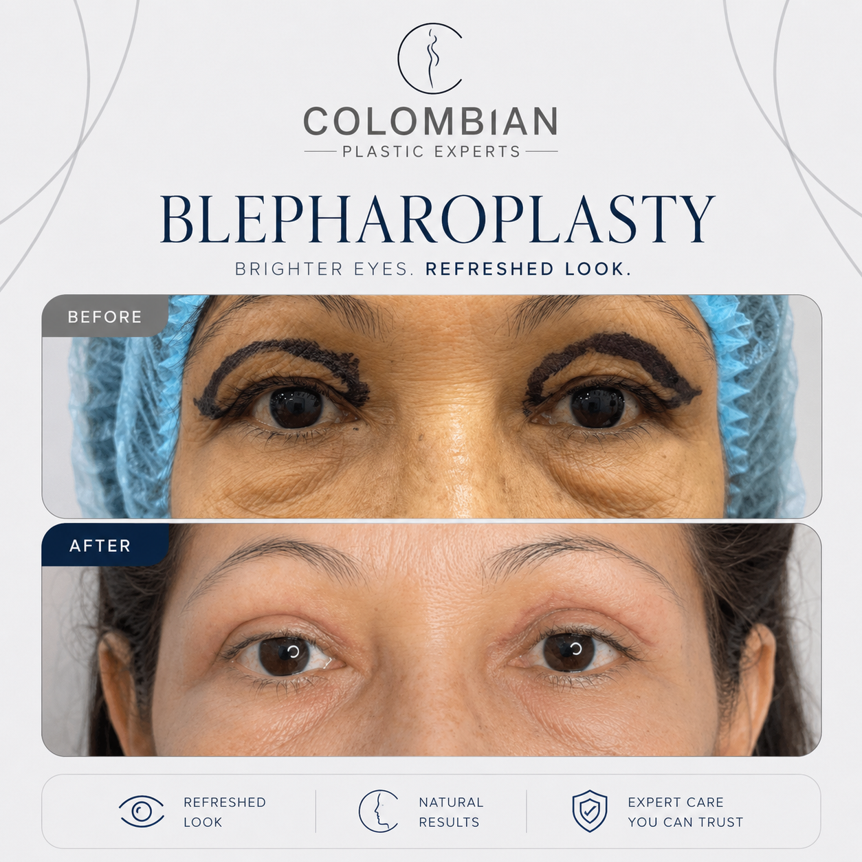 Miami Event Deposit | Dr. Neyfer Figueroa | 2 or more procedures